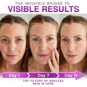 LumeDerm –  Advanced Microneedle Patch