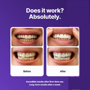 BrightViolet - Purple Teeth Whitening Strips