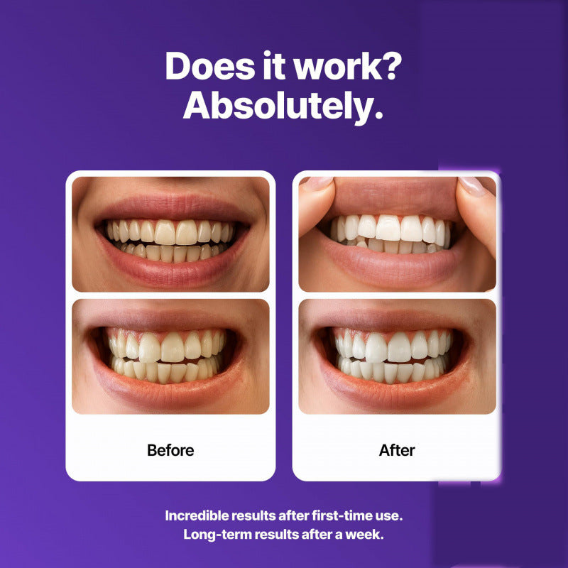 BrightViolet - Purple Teeth Whitening Strips