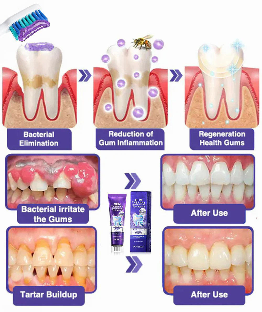 Dentova – Bee Venom Dental Care Toothpaste