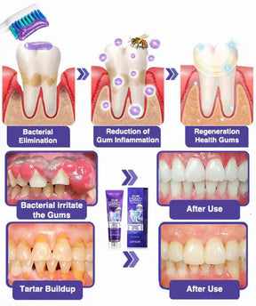 Dentova – Bee Venom Dental Care Toothpaste