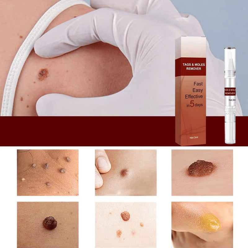 ClearGuard – Effective Wart Removal Pen
