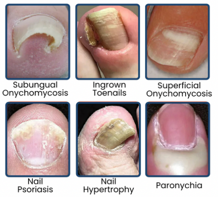 NailRevive Pro – Deep Care Patches