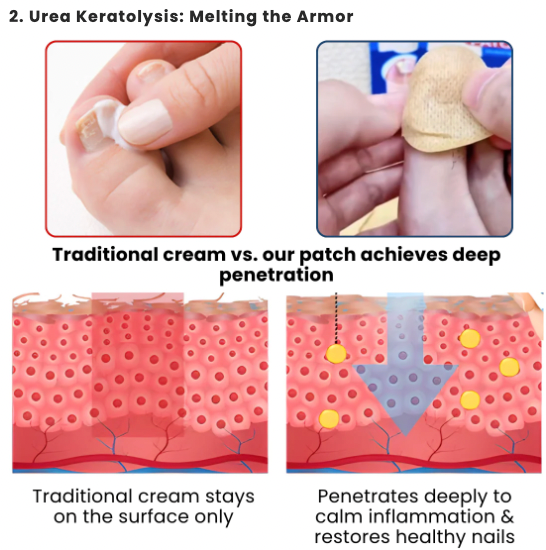 NailRevive Pro – Deep Care Patches