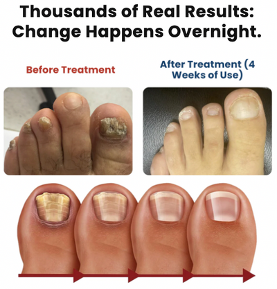 NailRevive Pro – Deep Care Patches