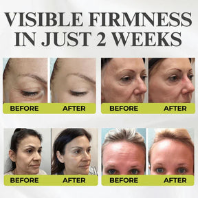 RevitaSkin – Wrinkle Lift Formula