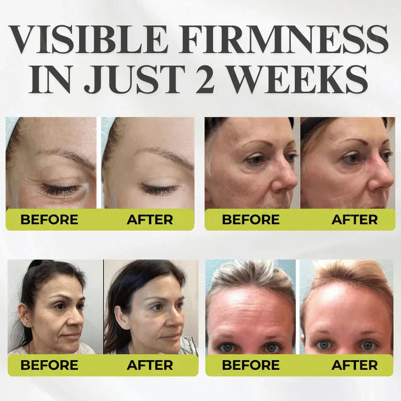 RevitaSkin – Wrinkle Lift Formula