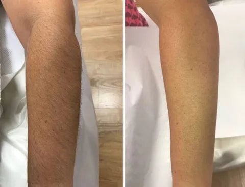 GlowSmooth – Moisturizing Hair Removal Spray