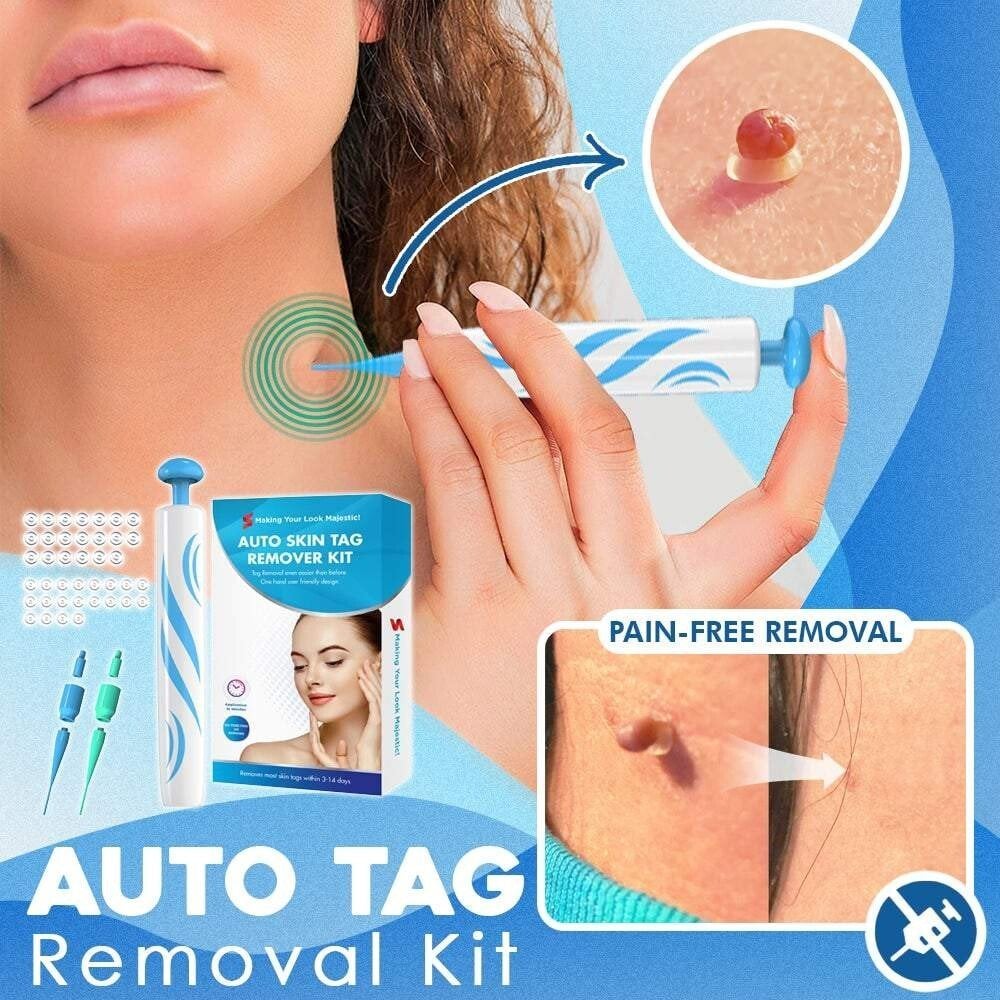 TagSnatch – Fast Auto Tag Removal Kit