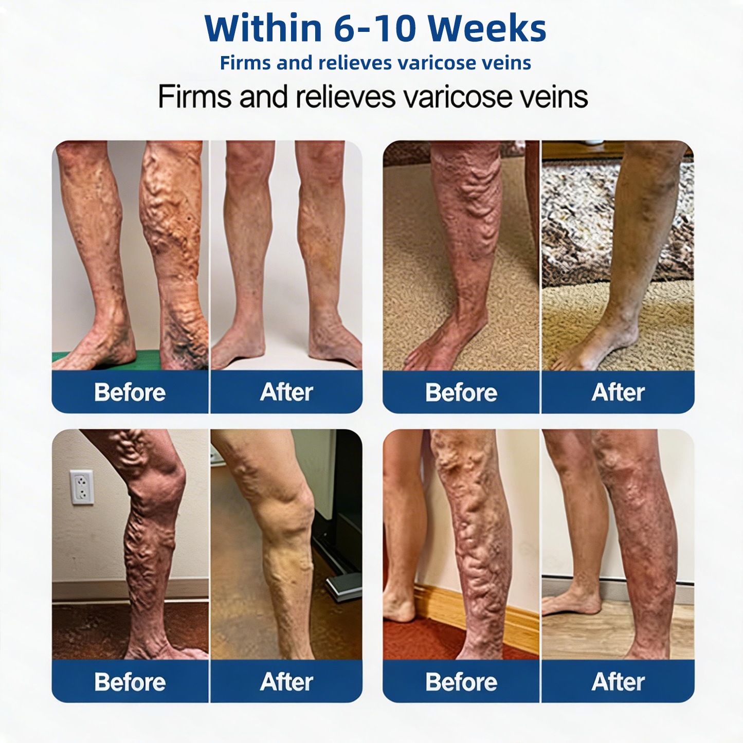 LegEase – Comfortable Vein Care Patch System