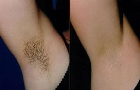 GlowSmooth – Moisturizing Hair Removal Spray