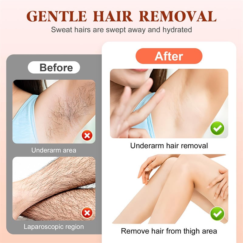 SkinEase – Smooth Finish Hair Removal Cream