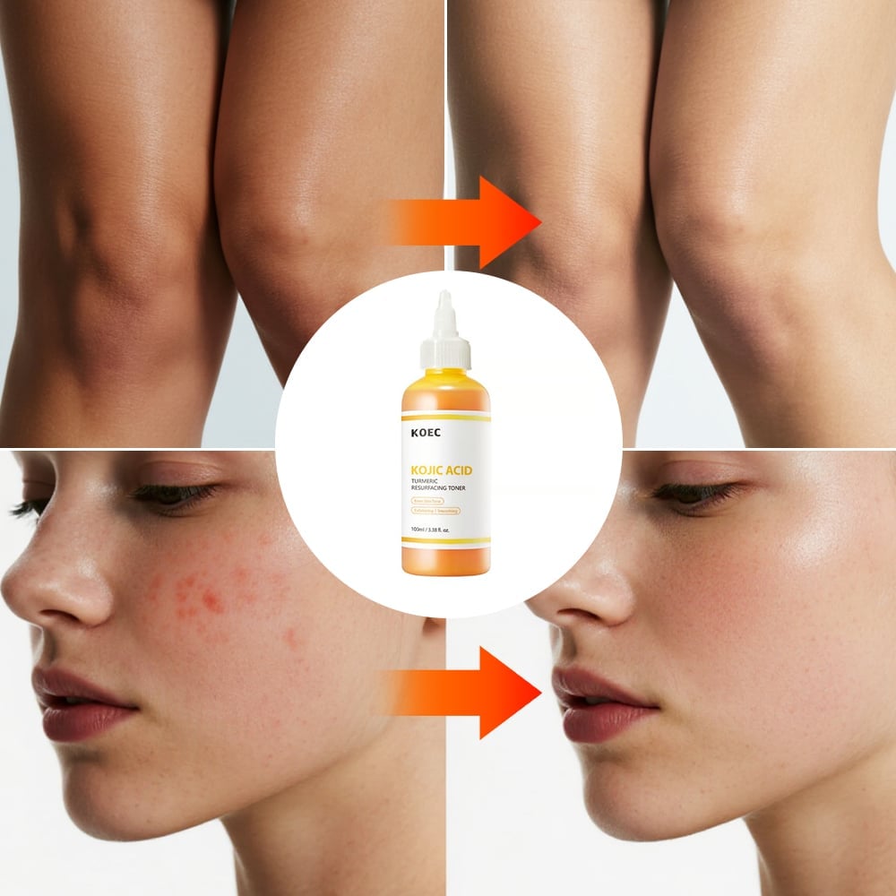 PureGlow – Kojic Acid Herbal Brightening Serum