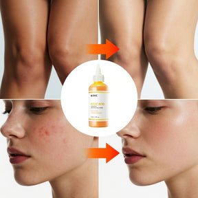PureGlow – Kojic Acid Herbal Brightening Serum