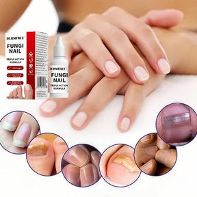PureRoot – Extra Strength Toenail Treatment