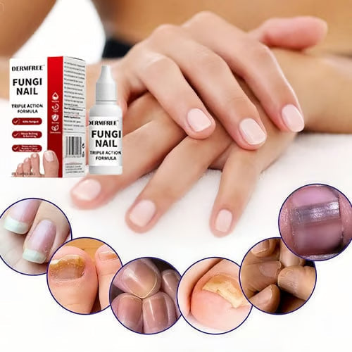 PureRoot – Extra Strength Toenail Treatment