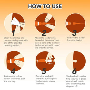 ClearSkin Pro - 2 in 1 Skin Tag Remover Device