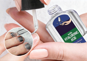 NailRevive Pro – Antifungal Repair Solution