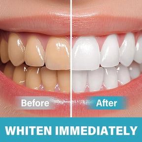 SmileBright- Instant Teeth Whitening Pigment