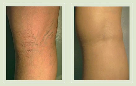 GlowLegs – Airbrushed Finish Leg Concealer