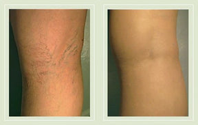 GlowLegs – Airbrushed Finish Leg Concealer