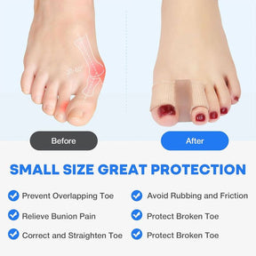 ToeAlign – Bunion Corrector System