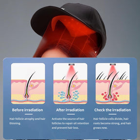 HairLuxe – Multi Mode Hair Wellness  Cap