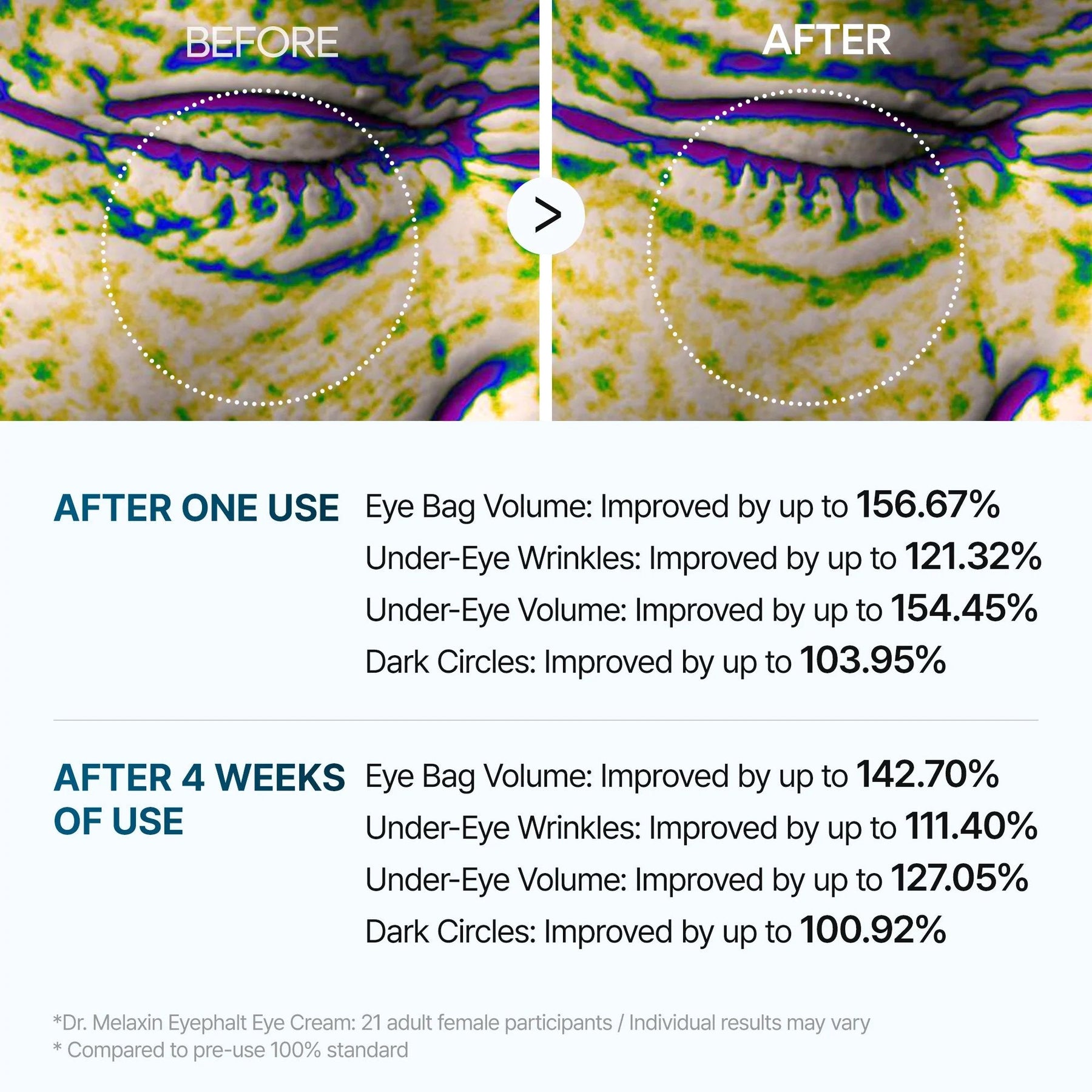 LumeLift – Rapid Eyebag Repair Cream