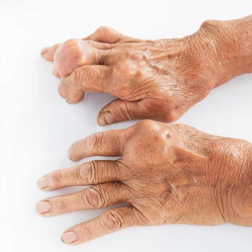 FlexiRelief – Advanced Microneedle Joint Comfort Patch