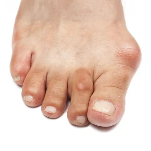 FlexiRelief – Advanced Microneedle Joint Comfort Patch