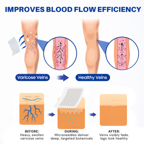 LegEase – Comfortable Vein Care Patch System