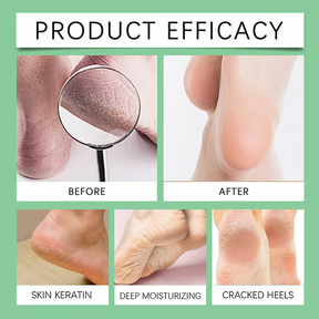 HeelCare – Effective Foot Callus Removal Tool