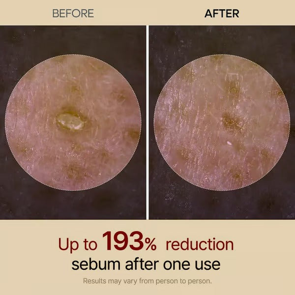 SkinAura – Mild Exfoliating Black Rice Ampoule Serum