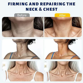 DermaRoll Neck – Sculpting Lift Cream