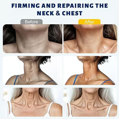 DermaRoll Neck – Sculpting Lift Cream