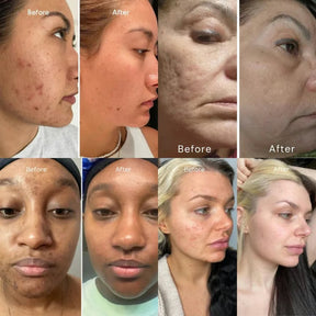 DermaRoll Neck – Sculpting Lift Cream
