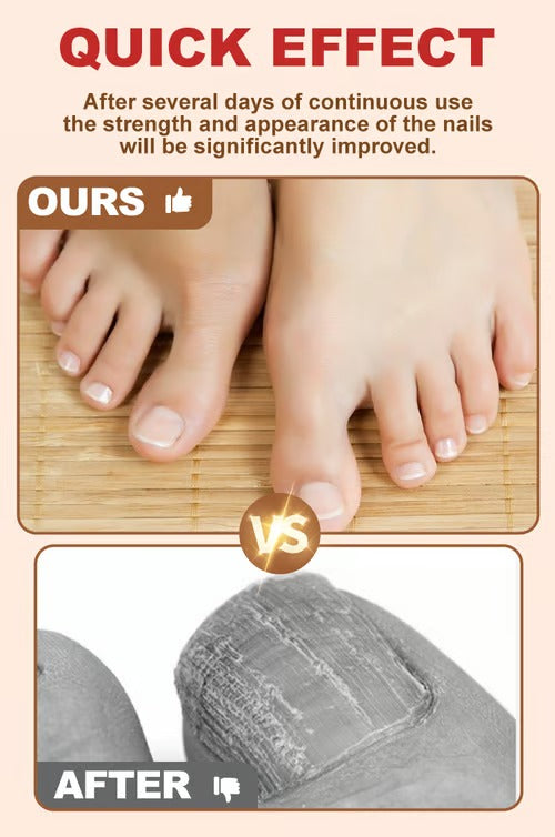 BeautyTips – Nail Repair Miracle Drops