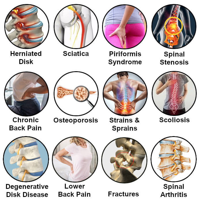 MagnaSpine – Orthopedic Magnetic Support Belt
