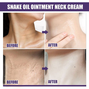 SkinLift – Hydrating & Smoothing Neck-Firming Cream