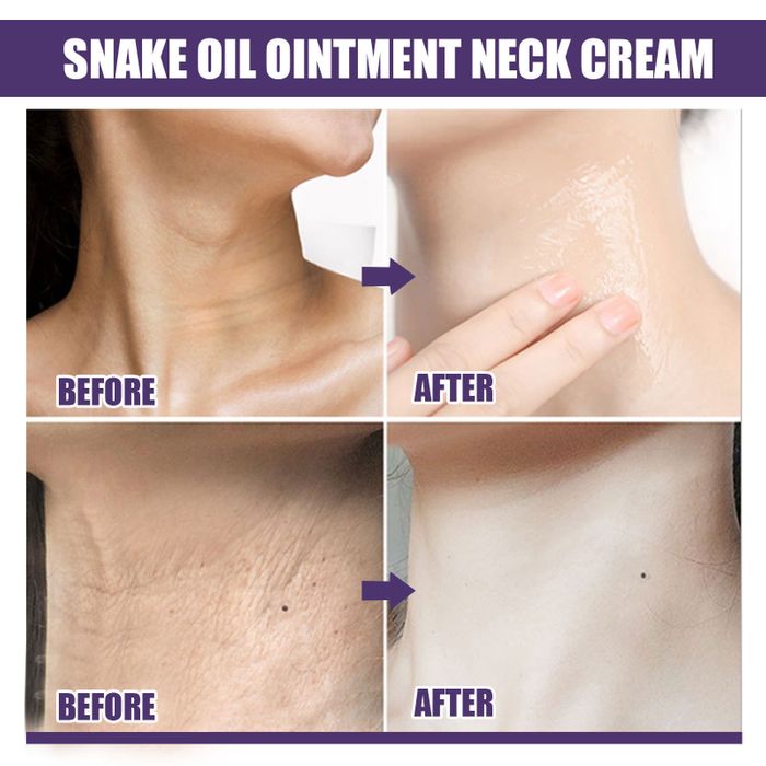 SkinLift – Hydrating & Smoothing Neck-Firming Cream