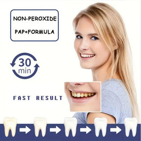 AuraBright – Advanced PAP+ Teeth Whitening Strips