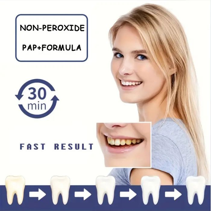 AuraBright – Advanced PAP+ Teeth Whitening Strips