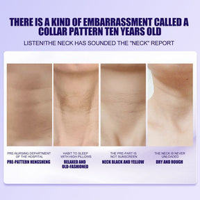 SkinLift – Hydrating & Smoothing Neck-Firming Cream