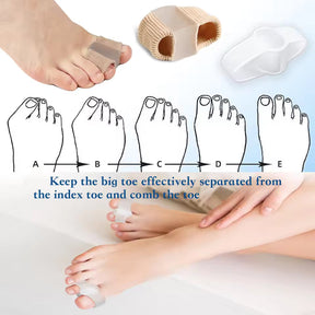 ToeAlign – Bunion Corrector System
