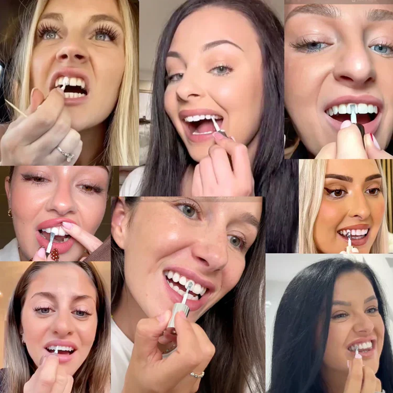 WhiteBloom – Instant Smile Brightener