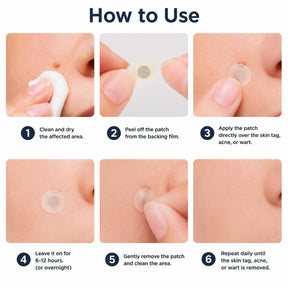 SkinNova – Dual Action Microneedle Acne Patch