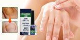 NailRenew - Natural Antifungal Nail Repair Solution