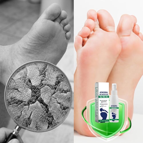 DryStep – Sweat Control Foot Care Spray
